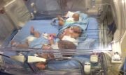 Bayi kembar Aceh batal di Head CT Scan