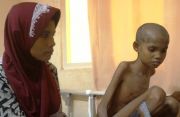 Nestapa Nasiran bocah dari Aceh Barat Daya